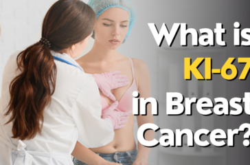 Ki-67-Breast-Cancer